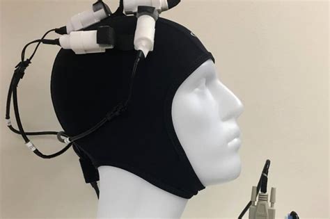 Transcranial Magnetic Stimulation