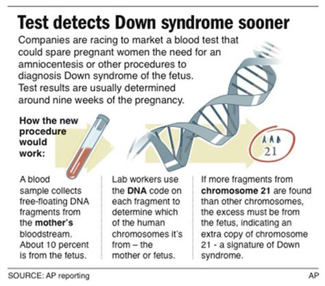 Comfort Or Conflict Earlier Down Syndrome Test