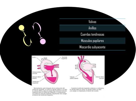 Insuficiencia Mitral Ppt