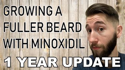 Minoxidil Beard Faq Beard Wiki 48 Off