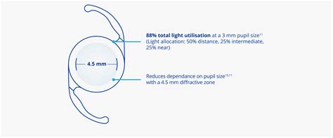 Clareoniq Panoptix Trifocal Iol Lens Option For Cataract Patients Myalcon International