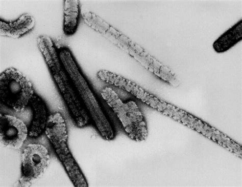 Signs and symptoms typically begin abruptly within five to 10 days of infection with ebola virus or marburg virus. Marburg Virus - Ebola's Deadly Cousin | Emerging Viral ...