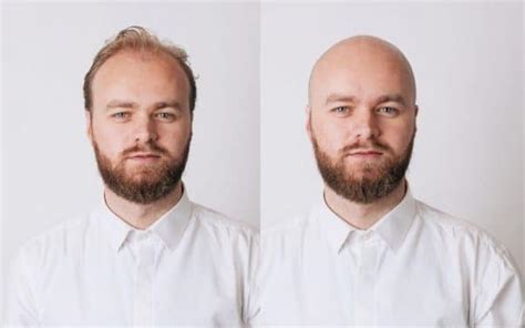 What Would I Look Like Bald Bald Editor The Bald Company