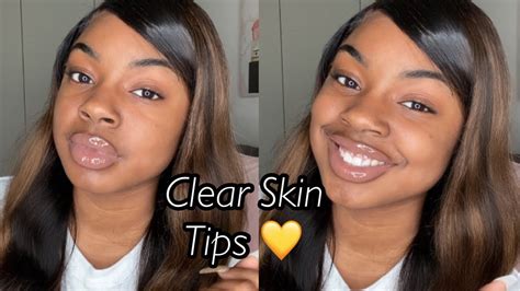 How To Get Clear Skin Fast Ft Teami Blends Luxury Tot Youtube