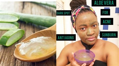 Diy Aloe Vera Face Mask For Acne And Acne Scars Aloe Vera Plant For