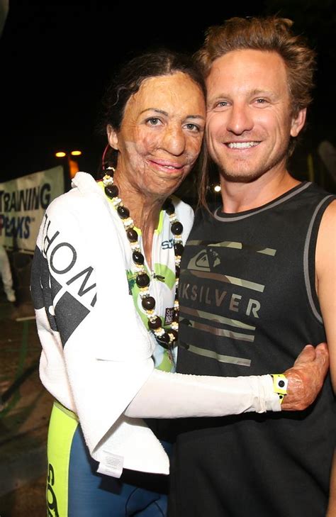 Turia Pitt Completes Ironman World Championships In Hawaii