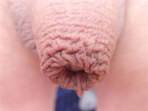 Naked Cock 75 Pics Xhamster