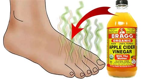 How To Easily Get Rid Of Smelly Feet With Apple Cider Vinegar Epic Natural Health
