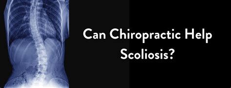 Can Chiropractic Help Scoliosis