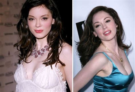 Rose Mcgowan Plastic Surgery Before And After Photos Celeblens