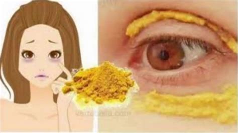 She Put Turmeric Around The Eyes And Days Later Something
