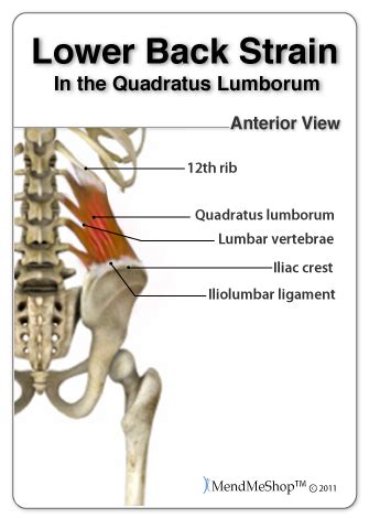 Within this group of back muscles you will find the latissimus dorsi, the trapezius, levator scapulae and the rhomboids. Lower Back Strain & Pain