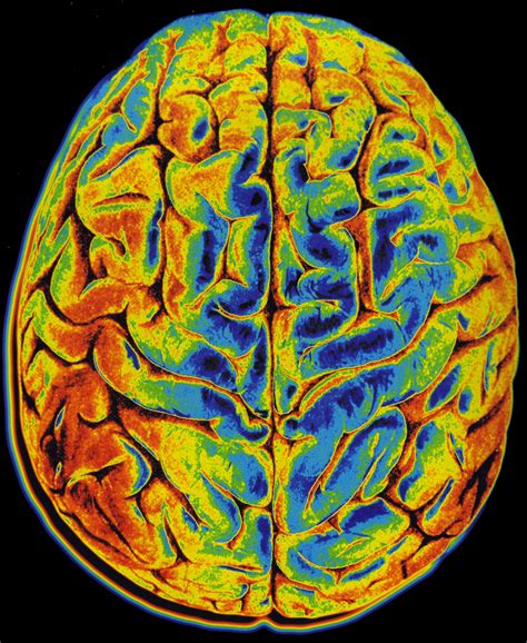 Brain Imaging Provides Window Into Consciousness Anthrobotic