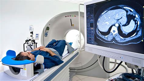 Know Your Radiation Risks From Medical Imaging Tests