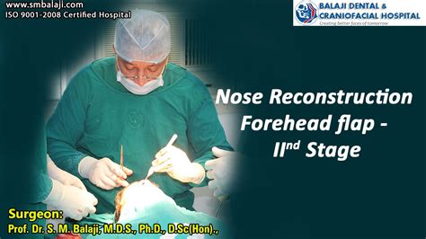 Nose Reconstruction Forehead Flap Ii Stage Youtube