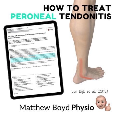 Peroneal Tendonitis Treatment Exercises