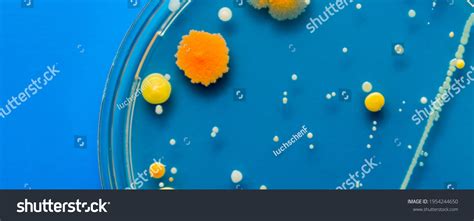 Yellow Orange Bacterial Colonies On Agar Stock Photo 1954244650