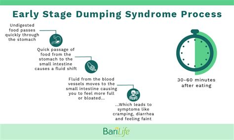 Management Of Dumping Syndrome