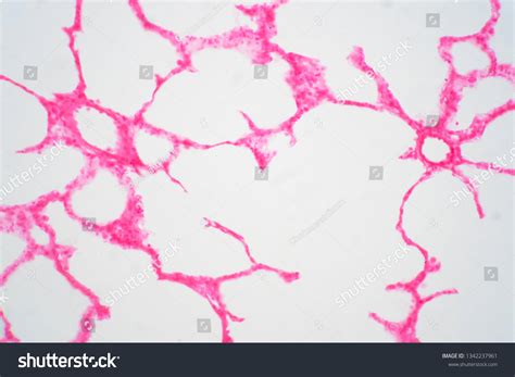 Photo De Stock Human Lung Tissue Under Microscope View 1342237961
