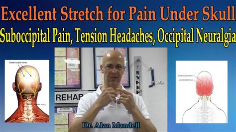 Excellent Stretch For Pain Under Skull Suboccipital Pain Tension