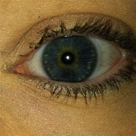 Pinterest Taught Me That I Have Partial Heterochromia Always Wondered Why I Had An Orange Ring