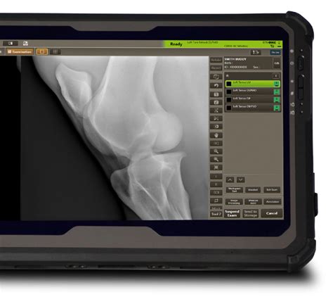 Sprint Ii Equine Dr Sounds Portable Veterinary Digital Radiography