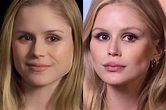The Truth About Erin Moriarty Plastic Surgery