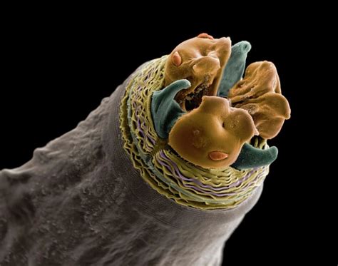 The Detail Of A Roundworm Head Shows The Parasites Mouth And Three