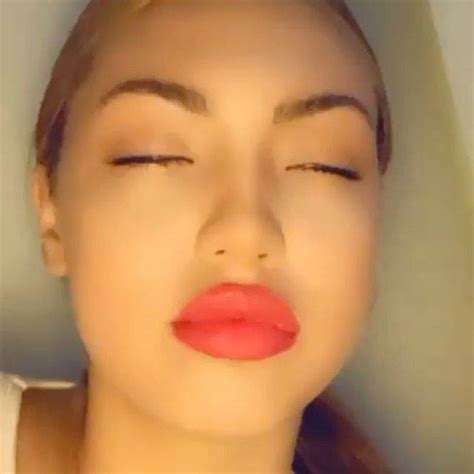 just look at these lips 💋💉 angelyussof what a beautiful face ️ angel received 1 5ml of lip