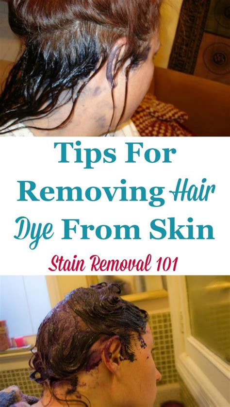 Leave it on for a few minutes and the color will disappear like houdini. Tips For Removing Hair Dye From Skin