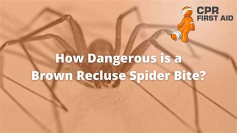 How Dangerous Is A Brown Recluse Spider Bite Cpr First Aid