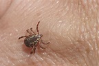 Rocky Mountain Spotted Fever Facts and Symptoms