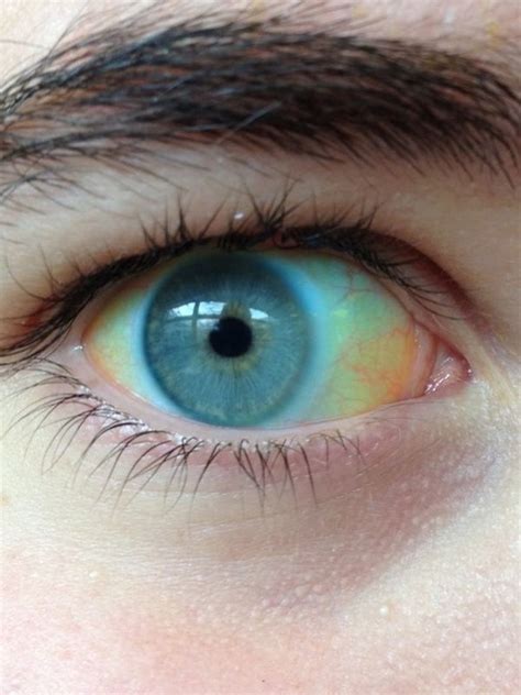 Jakie Choroby Zdradzają Oczy Co Można Wyczytać Z Oczu