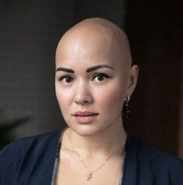Pin On Hairdare Bald Women