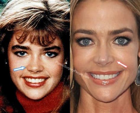 Denise Richards Before And After 2019