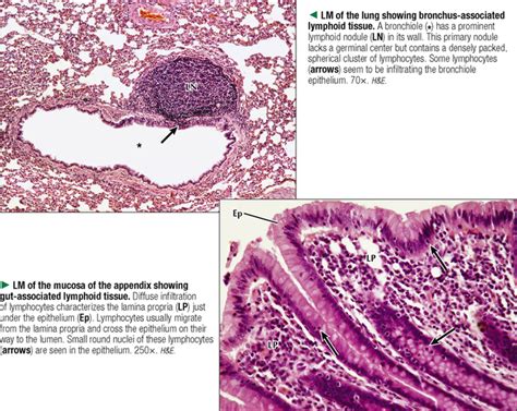 Gut Associated Lymphoid Tissue Histology