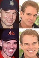 Billy Bob Thornton Plastic Surgery Before and After Facelift and Botox ...