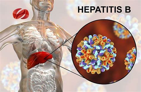 Control Y Prevención Virus De La Hepatitis B Consultorsalud