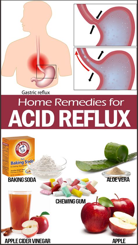 How To Get Rid Of Acid Reflux In Throat Immediately