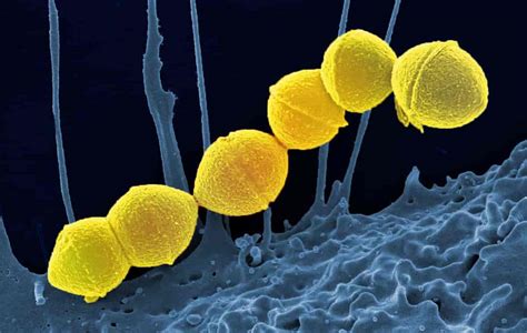 Streptococcus Constellatus Un Commensale Molto Pericoloso