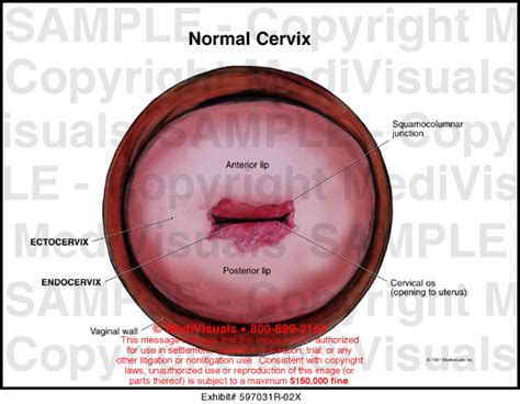 Normal Cervix Medical Illustration