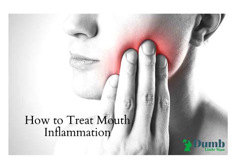 How To Treat Mouth Inflammation