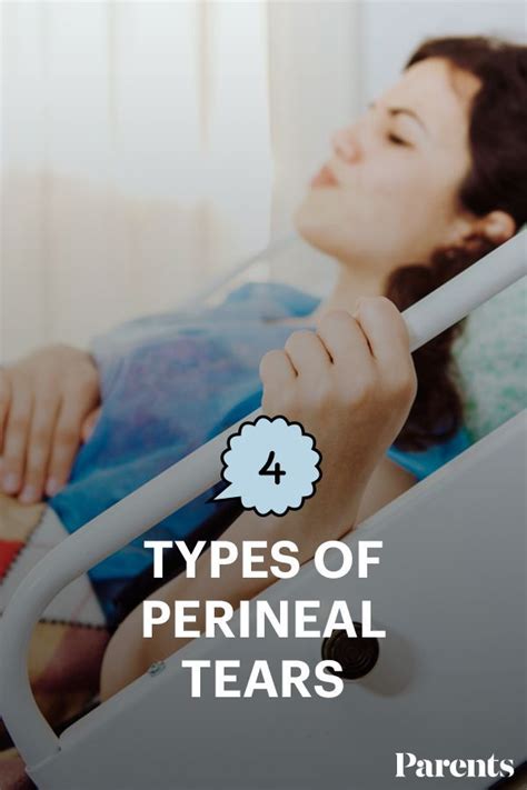 4 Types Of Perineal Tears Perineal Tear Tears Type