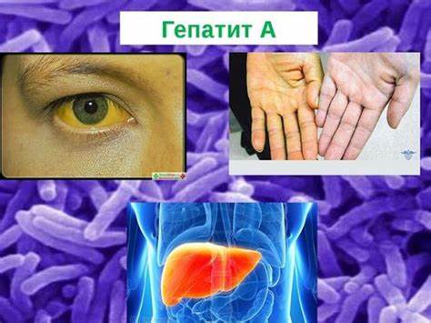 Хронический вирусный гепатит в диета Принципы медикаментозного лечения и немедикаментозной коррекции Принципы медикаментозного лечения и немедикаментозной коррекции Хронический вирусный гепатит в диета