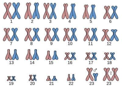 S Ndrome De Down O Trisom A Del Cromosoma Reproducci N Asistida