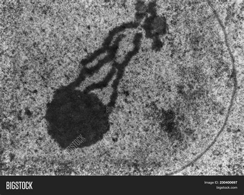 Electron Microscope Images Of Chromosomes