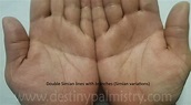 Double Simian or One Simian Line on the Palm - Destiny Palmistry