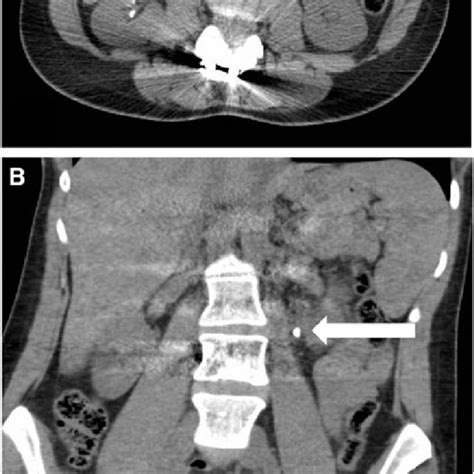 Representative Selection Of Ct Abdomen And Pelvis Images Showing