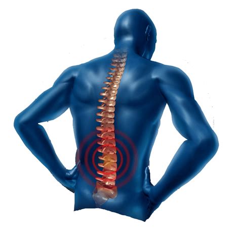 Back Pain Png Images Transparent Free Download