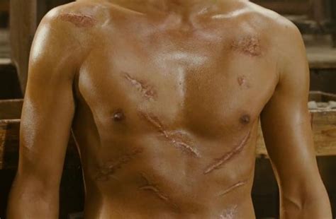 Girls What Do You Think Of A Man Body Scars Like This Girlsaskguys